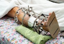 Ногу намотало на колесо. Врачи спасли мужчину в Петропавловске