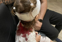 Двухлетняя девочка пробила себе голову в развлекательном центре в Костанае