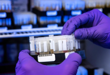 Суточная заболеваемость ковидом продолжает расти в Казахстане