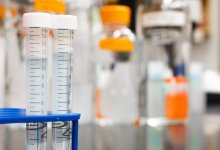 За сутки 427 казахстанцев заразились коронавирусом