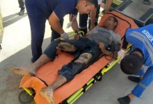 С ожогами 30% тела госпитализировали рабочего с автомойки в Шымкенте