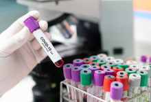 38 казахстанцев заболели коронавирусом и пневмонией за сутки