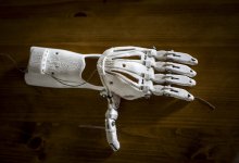 Мальчику с ампутированными руками установили протезы в ЗКО