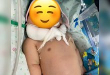 Заставили родить и сделали инвалидом: жительница Астаны обвиняет врачей в халатности