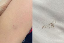 Учительница воткнула ручку в руку пятиклассника из-за его внешнего вида в Шымкенте