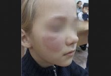 Третьеклассница обморозила лицо, когда шла в школу в Абае