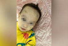 Ребенок вернулся из садика с сотрясением мозга в Актобе