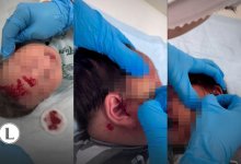 Режут лезвием младенцев в Атырау: почему лечение рахита хиджамой опасно?