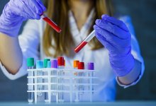 Свести на нет заболеваемость вирусным гепатитом планируют в Астане