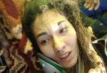 Казахстанку со сломанной рукой нашли под завалами в Турции