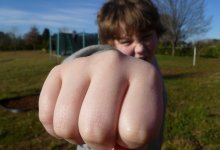 Не так поздоровался: 13-летний мальчик намеренно сломал руку своему сверстнику в Таразе