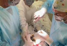 Более килограмма волос достали врачи из желудка девочки-подростка в Таразе