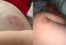 Маленькую девочку искусали до крови в детсаду Алматинской области