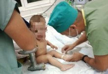 Руку двухлетнего ребенка затянуло в электромясорубку в Шымкенте