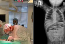 Проглотил соску: девятимесячного ребенка спасли врачи в Таразе