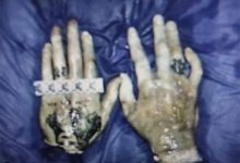 По кусочкам кожи на пальцах распознали труп карагандинца в Павлодарской области