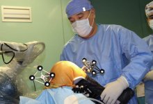 Робот впервые помог провести операцию в Алматы