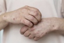 Карантин объявили во всех медучреждениях Абайской области