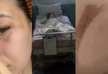 Кызылординка осталась инвалидом после конфликта с мужем, но дело не дошло до суда