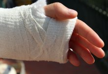 Ожоги и увечья получил рабочий в Степногорске
