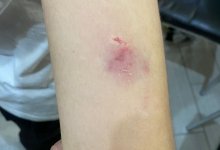 Школьника покусала собака во время урока в Актау (ВИДЕО)