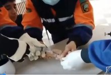 Спасатели помогли школьнику снять кольцо в Кызылординской области (ВИДЕО)