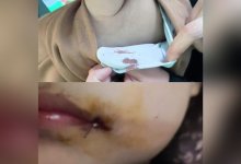 Трехлетняя девочка получила травму в детском центре в Кокшетау