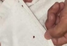 “До сих пор все чешется”: клопы атаковали пассажирку в поезде до Алматы