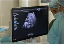 Внутриутробные операции начали делать в Казахстане