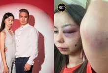 Пьяный стриптизер изуродовал лицо супруги