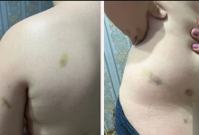 В Уральске мальчика избили в детском лагере