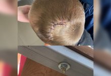 “Наложили больше 10 швов”: ребенок пострадал на игровой площадке в Карагандинской области