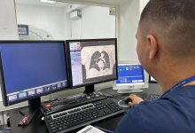 Всплеск случаев рака легких зафиксировали за 3 дня в Казахстане