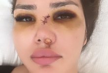 Незнакомец жестоко избил девушку на пляже в Актау (ВИДЕО)