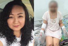 Подожженную мужем алматинку признали потерпевшей спустя 1,5 года