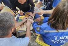 Девочка не смогла самостоятельно снять с пальца гайку в ЗКО (ВИДЕО)