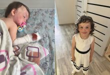 "Мама, почему у меня нет пальцев?": история девочки из Астаны, пережившей пожар