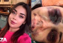Знакомство обернулось жестоким избиением для девушки