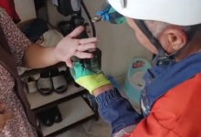 Сельчанка чуть не осталась без пальца в Жамбылской области