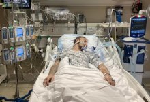 У донора пытались извлечь мозг, несмотря на его сопротивление