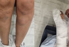 Спортсменам нельзя в тюрьму: алматинка обвинила мастера спорта в избиении