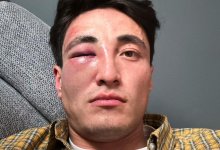 Фехтовальщик Ерлик Сертай получил травму глаза, защищая незнакомку