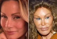 Умерла знаменитая жертва пластической хирургии – "женщина-кошка"