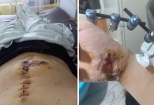 "Его пытались убить": житель Уральска получил огнестрельное ранение у себя во дворе