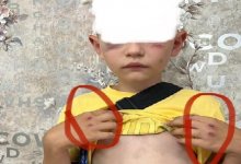 "Воспитывал кулаками": отчим жестоко избил пасынка в Лисаковске