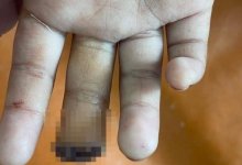 Части пальца лишилась девочка в школе Атырау