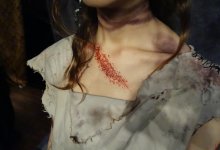 Отрезал уши и исполосовал тело: жертве насилия сделали операцию