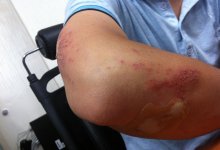 Гематомы, боли в пояснице и голове: отчима подростков задержали в Жамбылской области