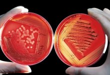 Детей в Туркменистане кормили опасным мясом из Kaзахстана