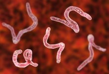 Червя вытащили из мозга мужчины, жаловавшегося на слабеющее зрение